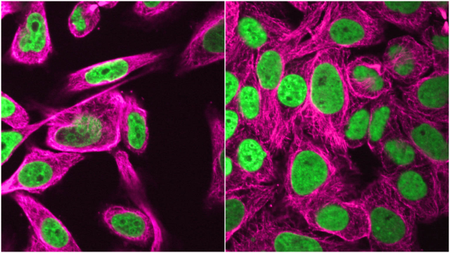 microscopic photographs of human cells